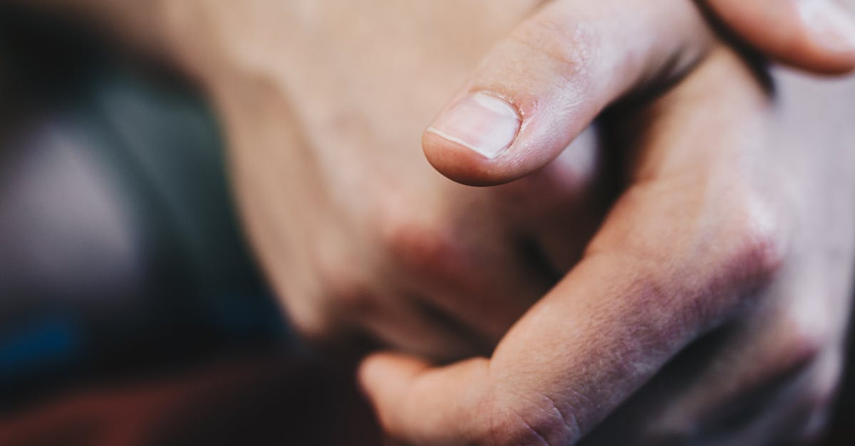 découvrez des conseils essentiels pour améliorer la santé de vos ongles. apprenez à prévenir les problèmes courants et à adopter une routine simple pour des ongles forts et beaux.