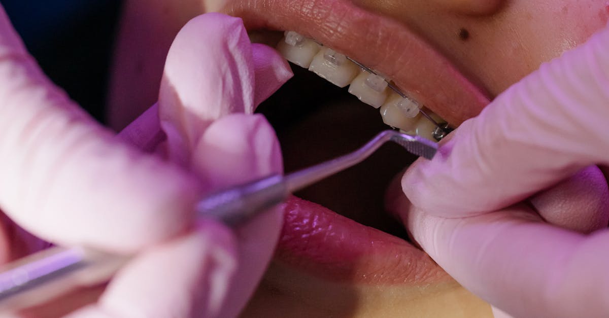 découvrez le rôle de l’orthodontiste : spécialiste des traitements dentaires pour corriger l’alignement des dents et des mâchoires. informations sur les soins, les appareils orthodontiques et les conseils pour un sourire harmonieux.
