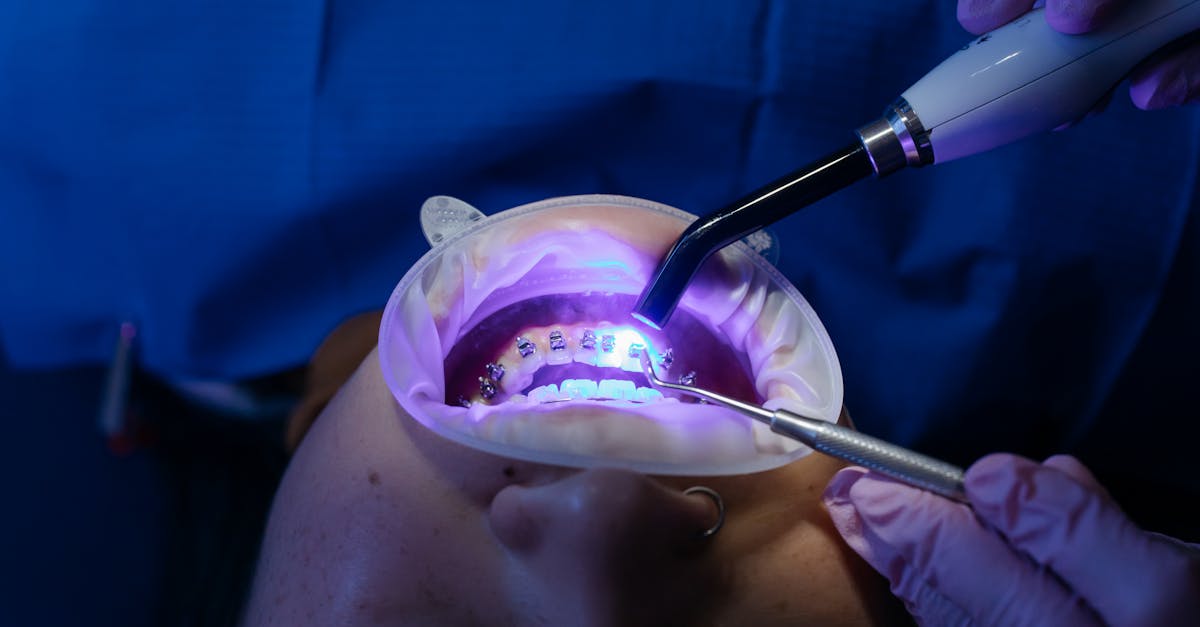 trouvez un orthodontiste qualifié pour améliorer votre sourire avec des solutions adaptées : appareils orthodontiques, aligneurs invisibles, traitements pour enfants et adultes. prenez rendez-vous dès aujourd’hui pour une consultation personnalisée.