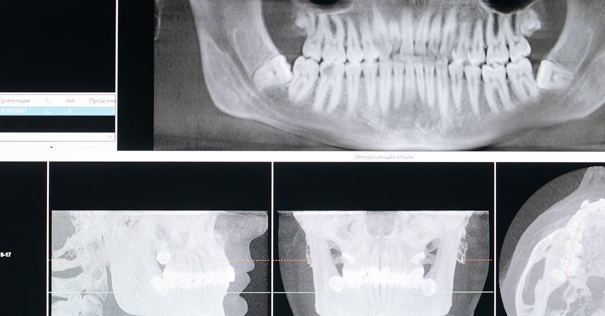 trouvez un orthodontiste qualifié pour améliorer l’alignement de vos dents et votre sourire. découvrez les traitements orthodontiques adaptés à tous les âges, des appareils dentaires classiques aux technologies invisibles.