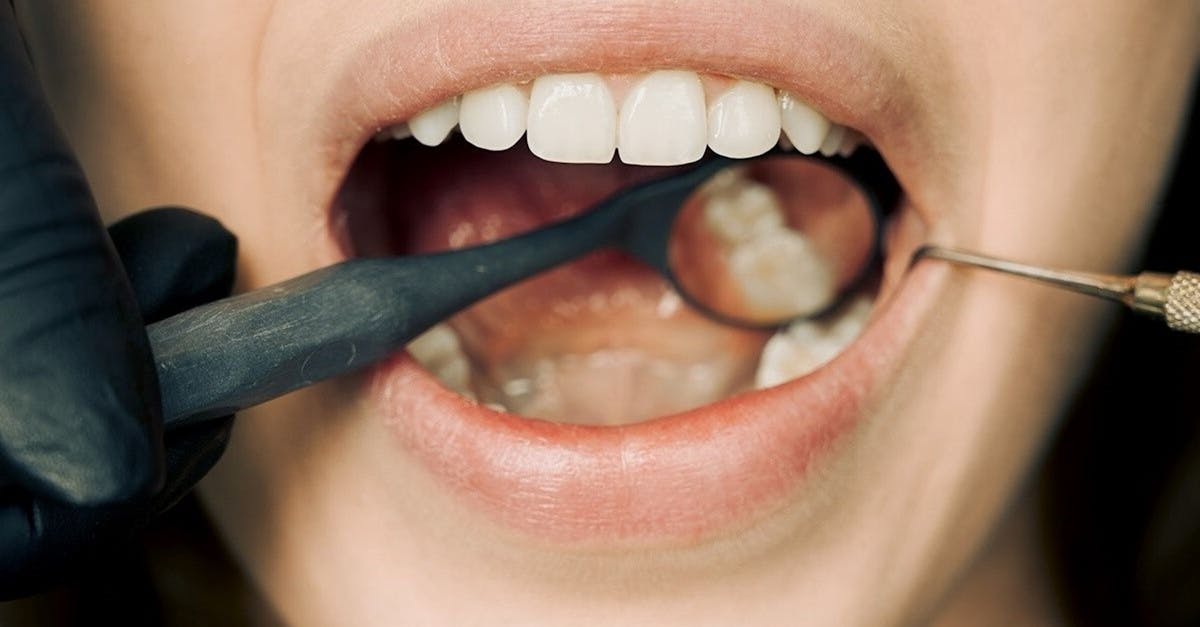 découvrez les causes, symptômes et traitements des aphtes et autres lésions buccales. informez-vous sur la prévention et les astuces pour soulager les douleurs liées aux ulcères dans la bouche.