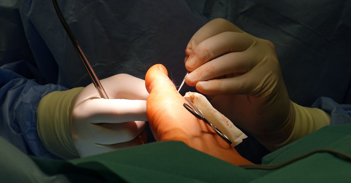 la chirurgie bariatrique est une intervention médicale visant à aider à la perte de poids chez les personnes obèses, en modifiant le système digestif pour réduire l'absorption des aliments et favoriser un mode de vie plus sain.