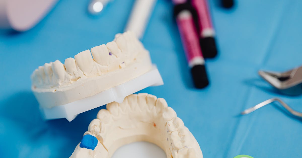 découvrez les risques associés aux bijoux dentaires, leurs impacts sur la santé bucco-dentaire et les précautions à prendre avant de les adopter.